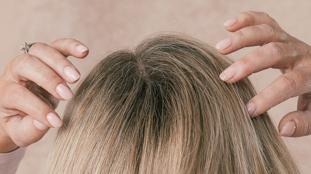 Scalp Buildup: What It Is, Why It Matters for Hair Growth, and How to Fix It