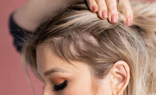 Woman lifting hair to reveal thinning at her scalp near the part, close-up side view with pink background