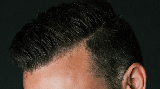 Close-up of a man’s head showing styled dark hair with a side part and visible hairline against a dark background