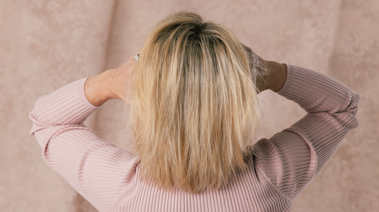 Woman from behind holding hands at her head to show thinning shoulder-length blonde hair on a pink backdrop