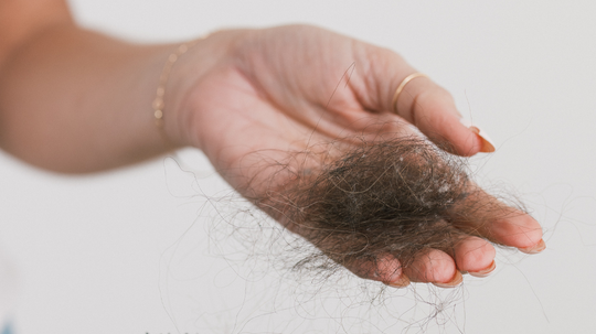Hand holding a clump of shed hair against a light background, illustrating female hair loss