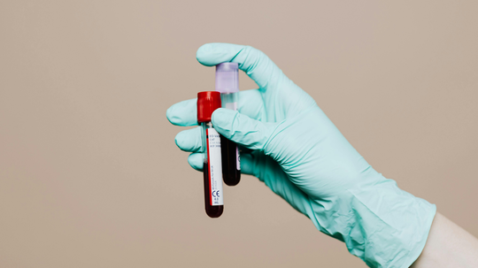 Gloved hand holding two blood sample tubes (red- and purple-capped) against a beige background