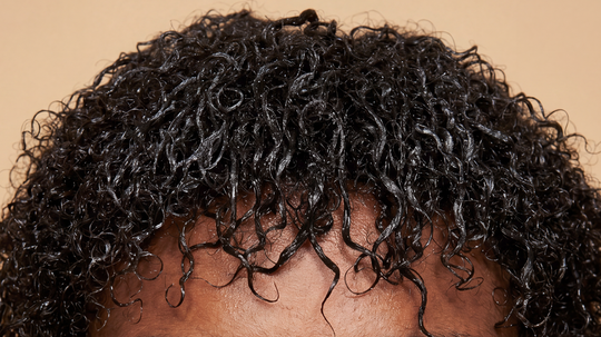 Wild Growth Hair Oil Side Effects: Buildup, Breakouts, and the Regrowth Myth