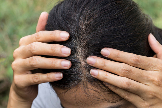 Person parting dark hair to reveal gray roots in a close-up with a blurred outdoor background