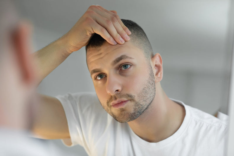Man examining his hairline in a mirror, concerned about hair thinning or hair loss