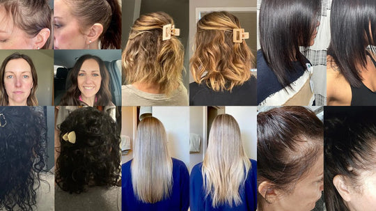 Collage of before-and-after photos showing women’s hair regrowth and improved thickness after using Growth Complex