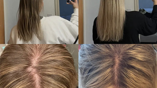 Woman showing before and after hair results from back and top views, revealing thicker, longer blonde hair