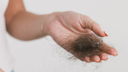 Hand holding a clump of shed hair against a neutral background, illustrating hair loss after stopping hormonal birth control
