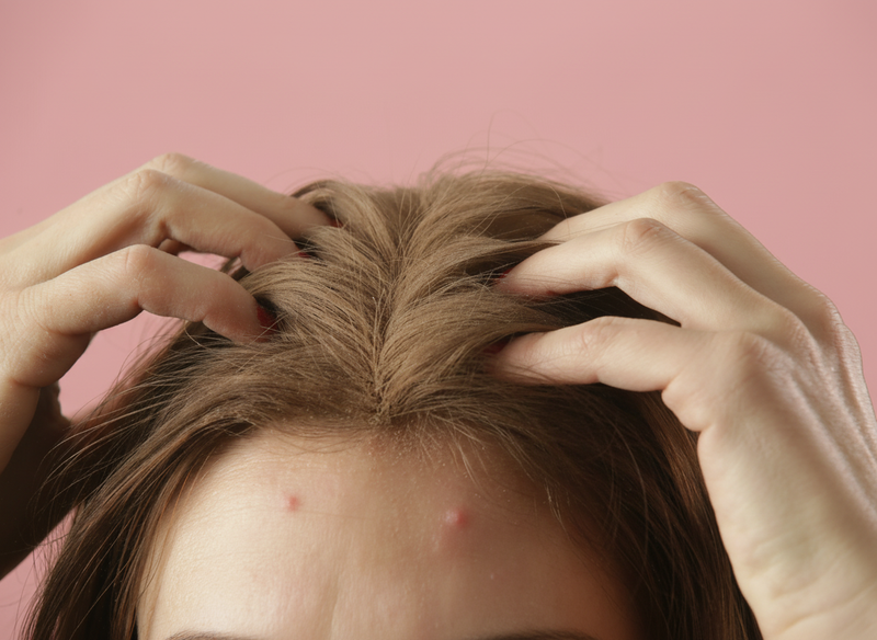 Hands parting brown hair to reveal two red pimples at the hairline against a pink background