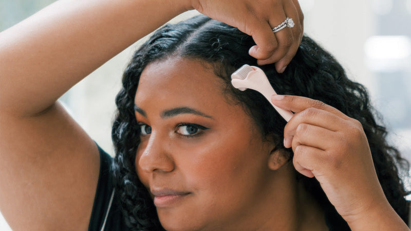 Derma Roller for Hair Loss: Does It Really Work?