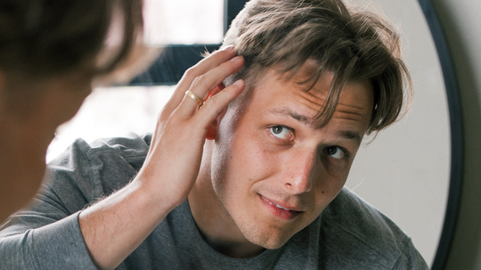 What Causes Hair Loss in Men? A Complete Guide to Every Type