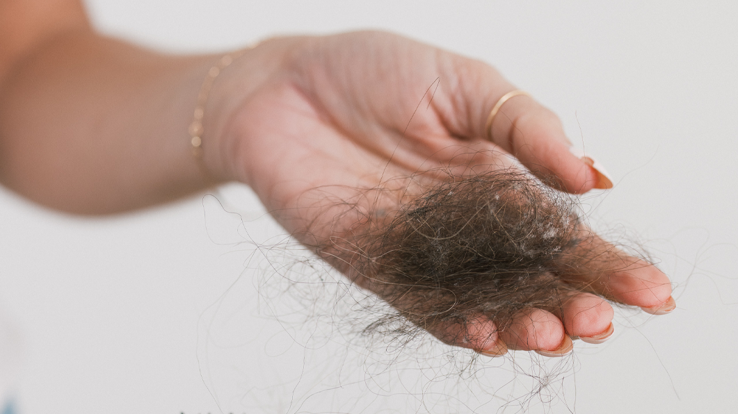 Testosterone and Hair Loss in Women: The Androgen Connection Behind Thinning