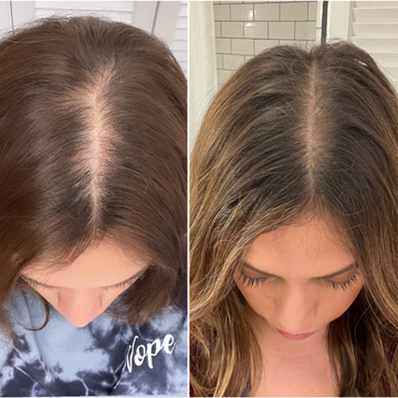 Before-and-after top-down hair part comparison: left shows wider, thinning part; right shows narrower, fuller part with highlights. Shirt text: Nope.